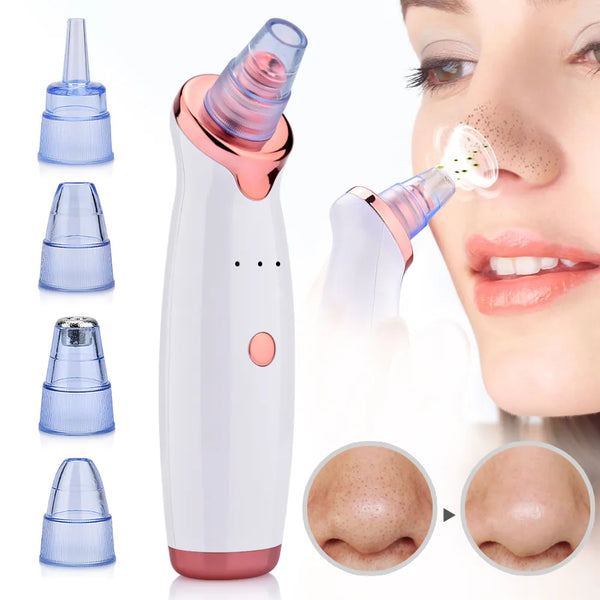 Blackhead and Pimple Remover - Vacuum Suction